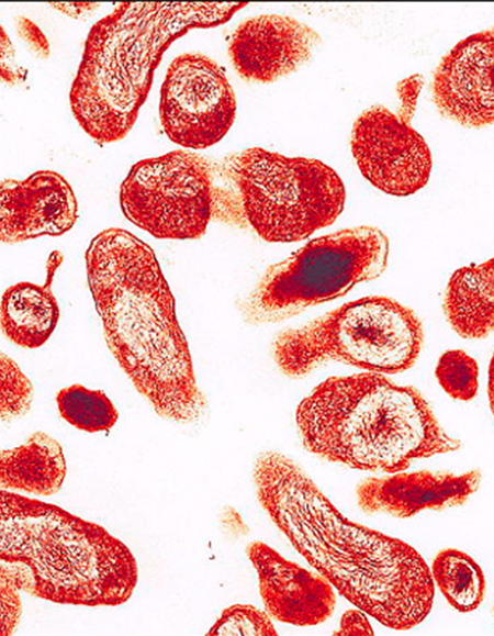Coxiella burnetii diagnosis