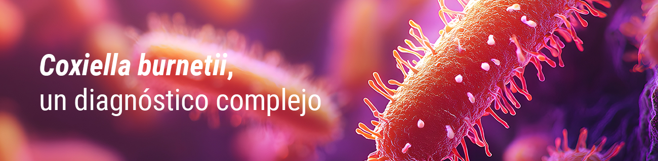 q fever diagnosis