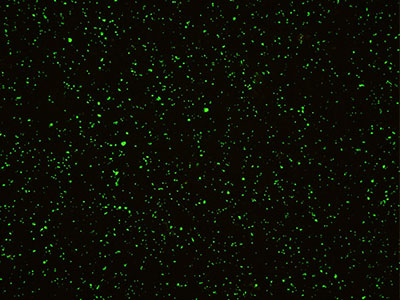 Coxiella positive