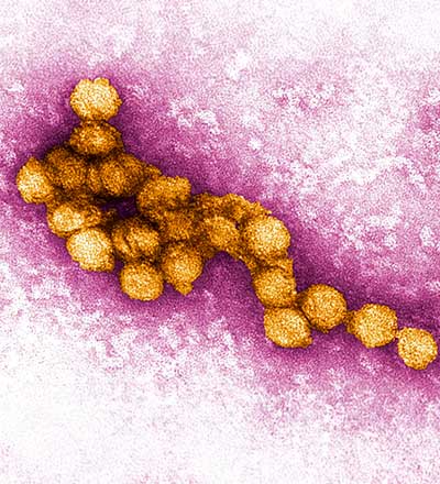 west nile symptoms