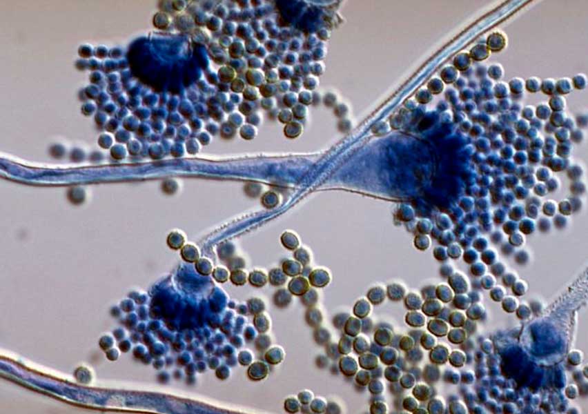 Aspergillus