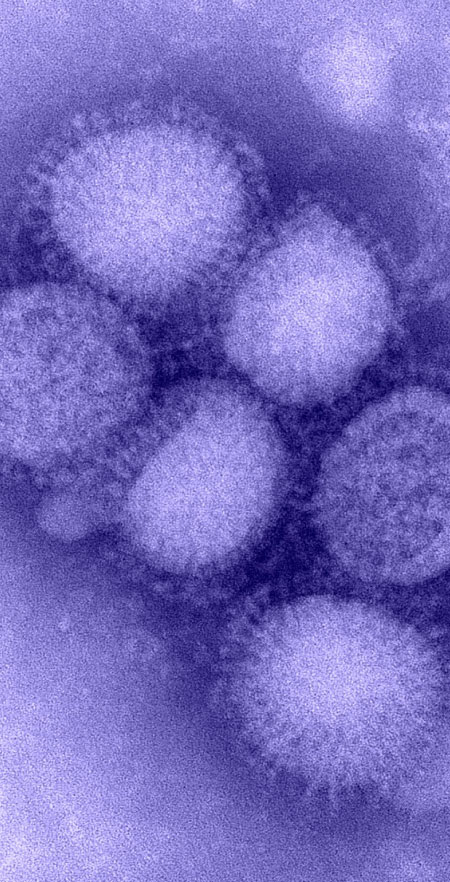 flu epidemic