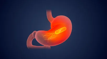 helicobacter pylori stool antigen