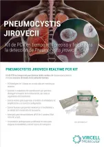 Diagnostico Pneumocystis Jirovecii