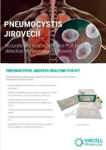 Pneumocystis Jirovecii Diagnosis